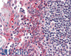 HEK293 lysate (10ug protein in RIPA buffer) over expressing Human UCN3 with DYKDDDDK tag probed with 46-722 (1ug/ml) in Lane A and probed with anti- DYKDDDDK Tag (1/3000) in lane C. Mock-transfected HEK293 probed with 46-722 (1mg/ml) in Lane B. Primary