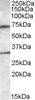 46-736 (0.2ug/ml) staining of Human Prostate lysate (35ug protein in RIPA buffer) . Detected by chemiluminescence.