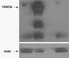 46-750 (1ug/ml) staining of Human Heart lysate (35ug protein in RIPA buffer) . Primary incubation was 1 hour. Detected by chemiluminescence.