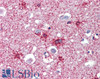 46-756 (2.5ug/ml) staining of paraffin embedded Human Breast. Steamed antigen retrieval with citrate buffer pH 6, AP-staining.