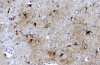 46-779 (4ug/ml) staining of paraffin embedded Human Cerebellum. Steamed antigen retrieval with citrate buffer pH 6, AP-staining. <strong>This data is from a previous batch, not on sale.</strong>
