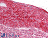 46-967 (0.3ug/ml) staining of Jurkat lysate (35ug protein in RIPA buffer) . Primary incubation was 1 hour. Detected by chemiluminescence.