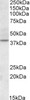 46-984 Immunofluorescence analysis of paraformaldehyde fixed HeLa cells, permeabilized with 0.15% Triton. Primary incubation 1hr (10ug/ml) followed by Alexa Fluor 488 secondary antibody (2ug/ml) , showing cytoplasmic/membrane staining. Actin filaments wer