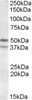 46-997 (3.75ug/ml) staining of paraffin embedded Human Thyroid. Steamed antigen retrieval with citrate buffer pH 6, AP-staining.