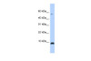 Antibody used in WB on Transfected 293T at 0.2-1 ug/ml.