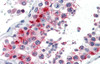 Antibody used in IHC on Human Testis at 5.0 ug/ml.