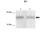 Antibody used in WB on MDA-MB231, MCF7 at 1:1000 (Lane 1: 10ug MDA-MB231 lysate, Lane 2: 10ug MCF7 lysate ) .