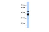 Antibody used in WB on Human brain at 0.2-1 ug/ml.