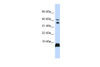 Antibody used in WB on Human 721_B cells at 0.2-1 ug/ml.