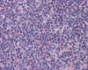 Antibody used in IHC on Human Spleen at 5.0 ug/ml.