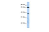 Antibody used in WB on Human Jurkat 0.2-1 ug/ml.