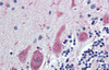 Antibody used in IHC on Human Brain at 5.0 ug/ml.