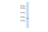 Antibody used in WB on Human Liver at 0.2-1 ug/ml.