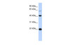 Antibody used in WB on Human kidney at 0.2-1 ug/ml.