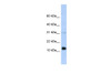 Antibody used in WB on Transfected 293T at 0.2-1 ug/ml.