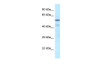 Antibody used in WB on Transfected 293T at 0.2-1 ug/ml.