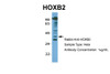 Antibody used in WB on Human Hela at 1 ug/ml.