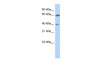 Antibody used in WB on Human Pancreas at 0.2-1 ug/ml.