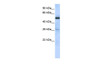 Antibody used in WB on Human HeLa at 0.2-1 ug/ml.