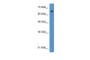 Antibody used in WB on Human HeLa at 0.2-1 ug/ml.