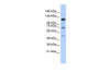 Antibody used in WB on Transfected 293T at 0.2-1 ug/ml.