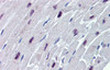 Antibody used in IHC on Human Heart.