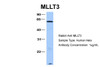 Antibody used in WB on Human Hela at 1 ug/ml.