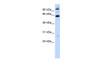 Antibody used in WB on Human HeLa at 0.2-1 ug/ml.