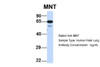 Antibody used in WB on Hum. Fetal Lung at 1 ug/ml.