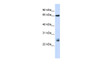 Antibody used in WB on Human HeLa at 0.2-1 ug/ml.