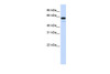 Antibody used in WB on Human Brain at 0.2-1 ug/ml.