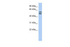 Antibody used in WB on Human HT1080 at 0.2-1 ug/ml.