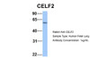 Antibody used in WB on Hum. Fetal Lung at 1 ug/ml.