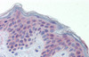 Antibody used in IHC on Human Skin.