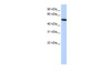 Antibody used in WB on Human HepG2 at 0.2-1 ug/ml.