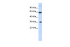 Antibody used in WB on Human Muscle at 0.2-1 ug/ml.