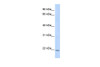 Antibody used in WB on Human HepG2 at 1 ug/ml.