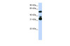 Antibody used in WB on Human Jurkat 0.2-1 ug/ml.