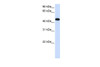 Antibody used in WB on Transfected 293T at 0.2-1 ug/ml.