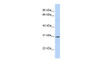 Antibody used in WB on Human Brain at 0.2-1 ug/ml.