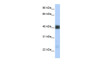 Antibody used in WB on Human Heart at 0.2-1 ug/ml.