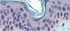 Antibody used in IHC on Human Skin at 5 ug/ml.