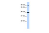 Antibody used in WB on Human 721_B at 0.2-1 ug/ml.