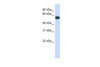 Antibody used in WB on Human Lung at 0.2-1 ug/ml.