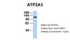 Antibody used in WB on Human MCF7 at 1 ug/ml.