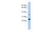 Antibody used in WB on Human MCF-7 at 0.2-1 ug/ml.