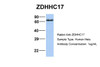 Antibody used in WB on Human Hela at 1 ug/ml.