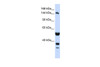 Antibody used in WB on Human HeLa at 0.2-1 ug/ml.