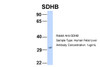 Antibody used in WB on Hum. Fetal Liver at 1 ug/ml.