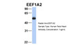 Antibody used in WB on Hum. Fetal Heart at 1 ug/ml.